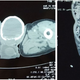 Image for article titled A Man's Worm Infection Left Him with a 'Stony Hard' Testicle